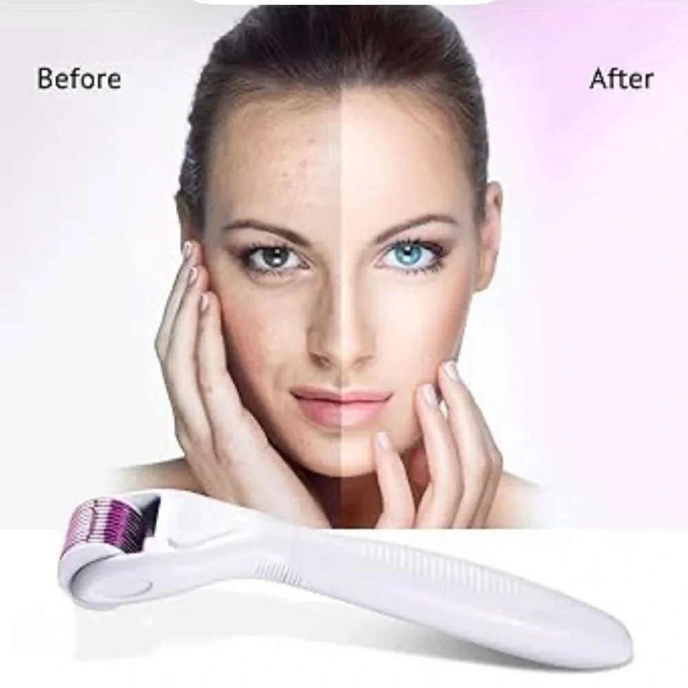 Sephora miracle microneedling
