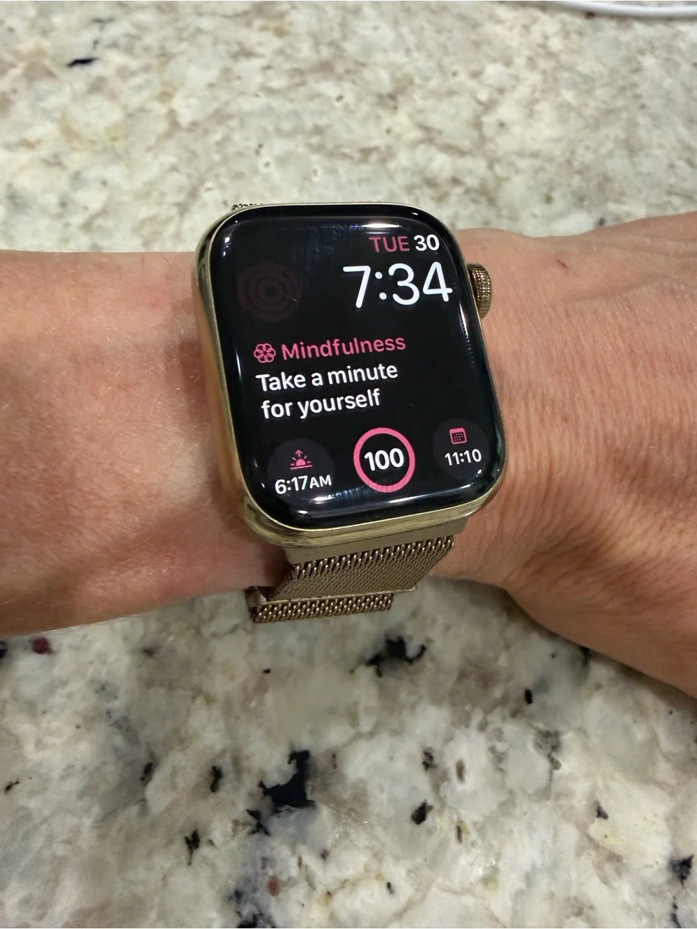 Apple watch series