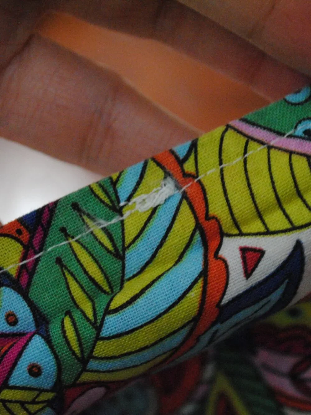 N/A this surgical