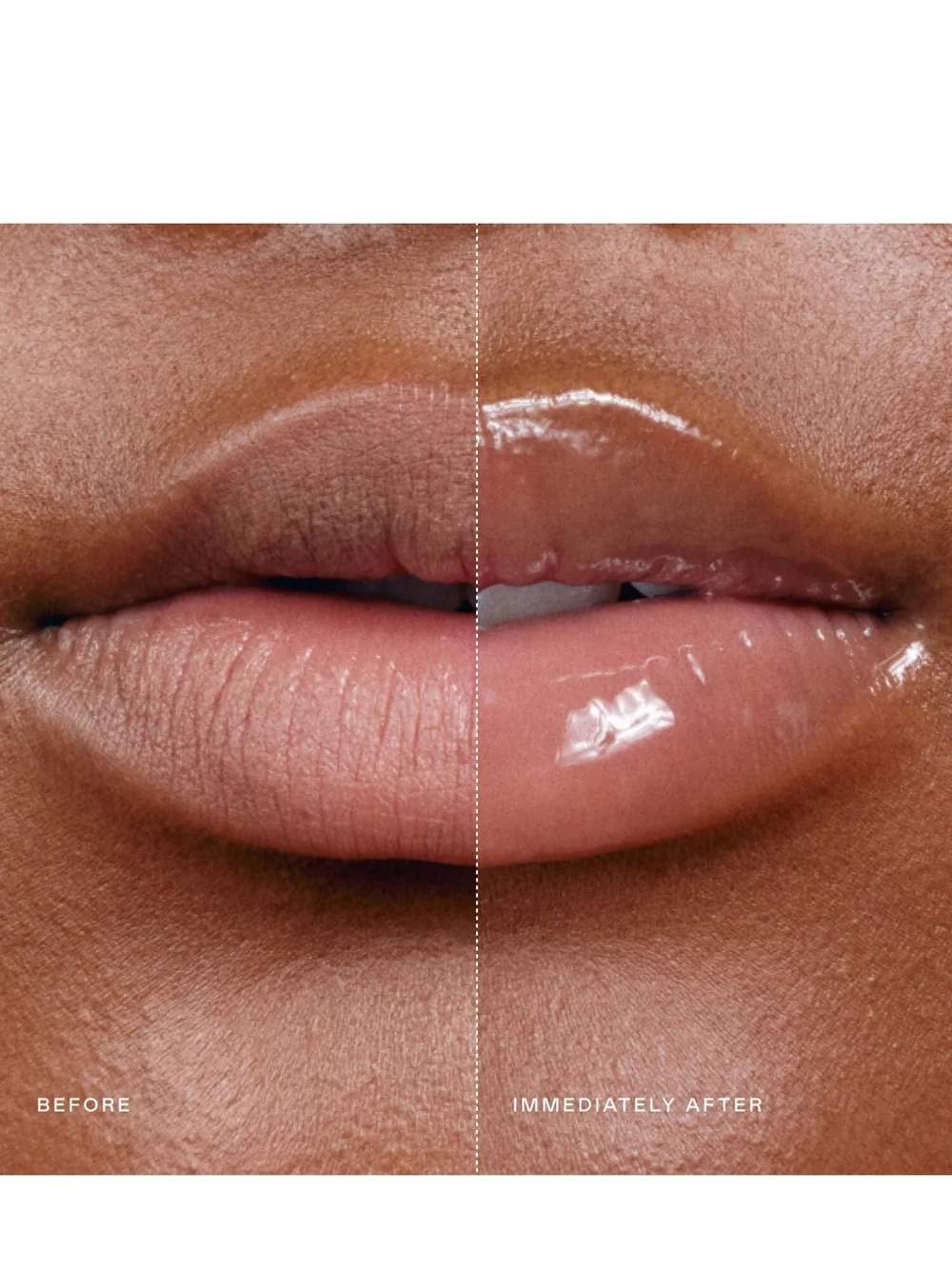 Eadem lip softening