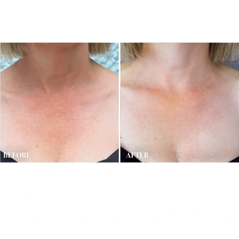 NECK And Decollete Firming Cream