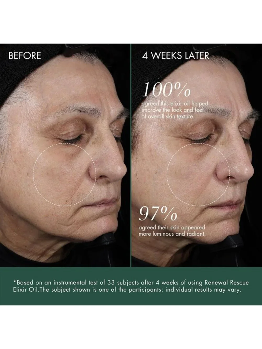 Renewal Discovery Set - Rescue Elixir Oil & Moisturizing Night Cream Trial Kit